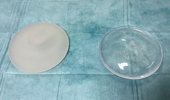 Comparaison d'implants mammaires en silicone et en serum physiologique
